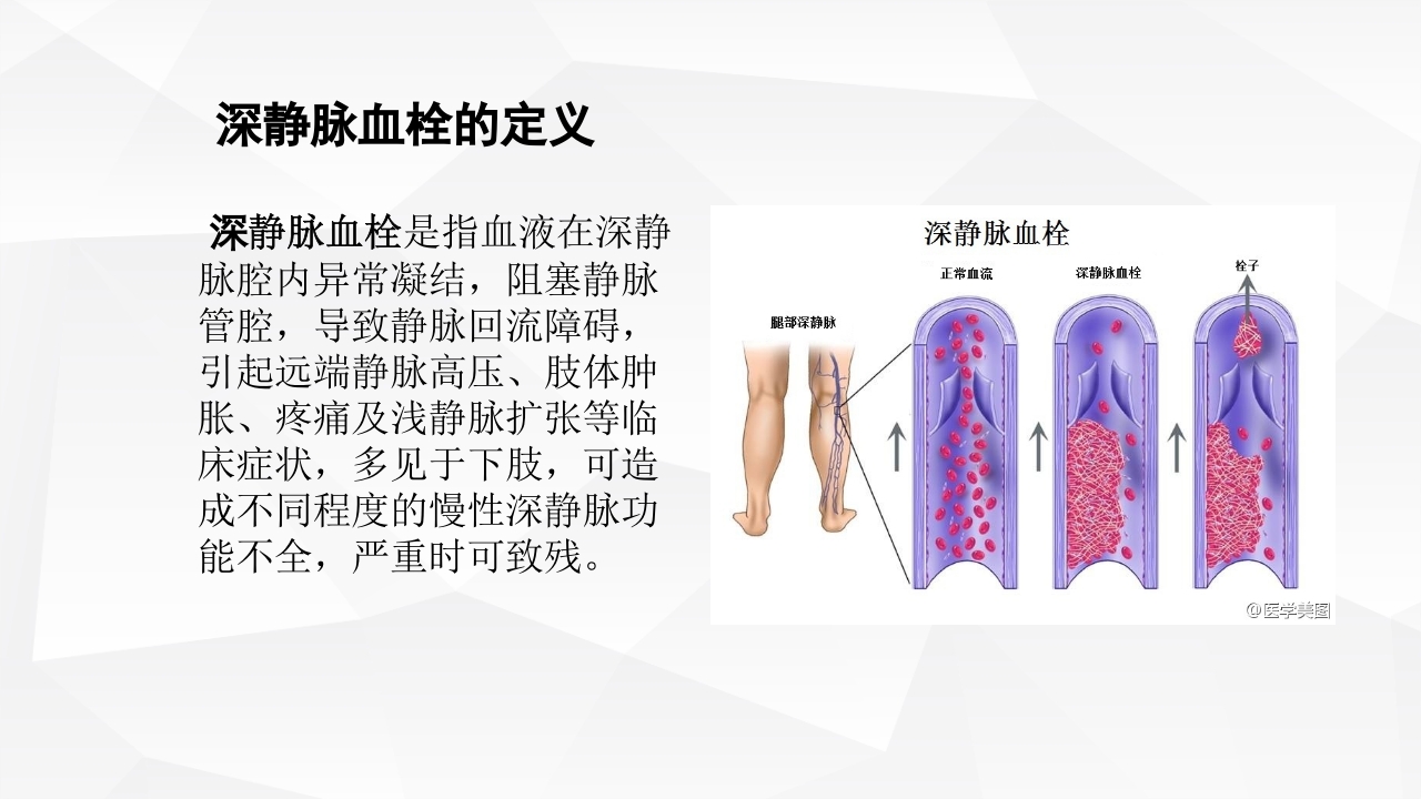 运用PDCA管理降低深静脉血栓的发生率ppt下载2