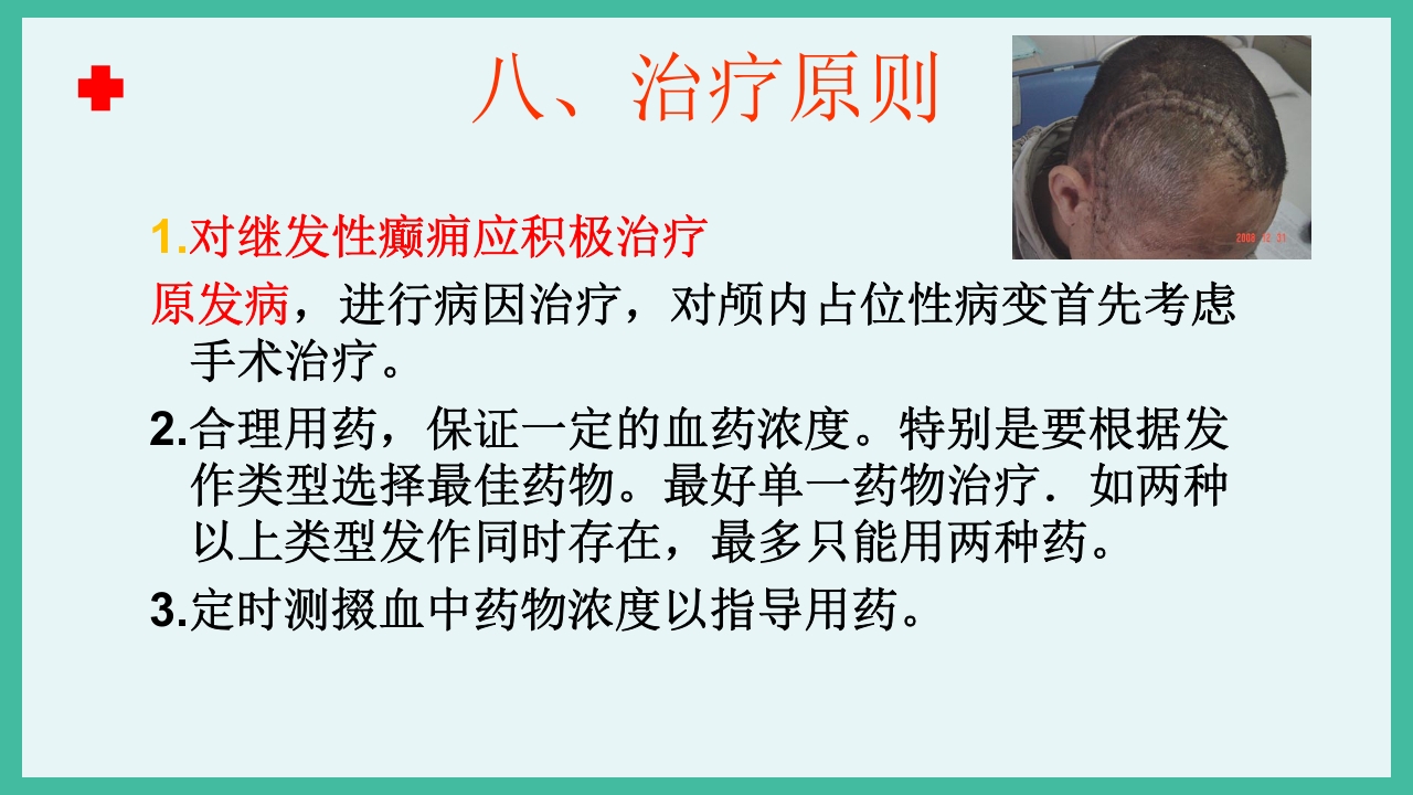 癫痫急救护理ppt课件下载11