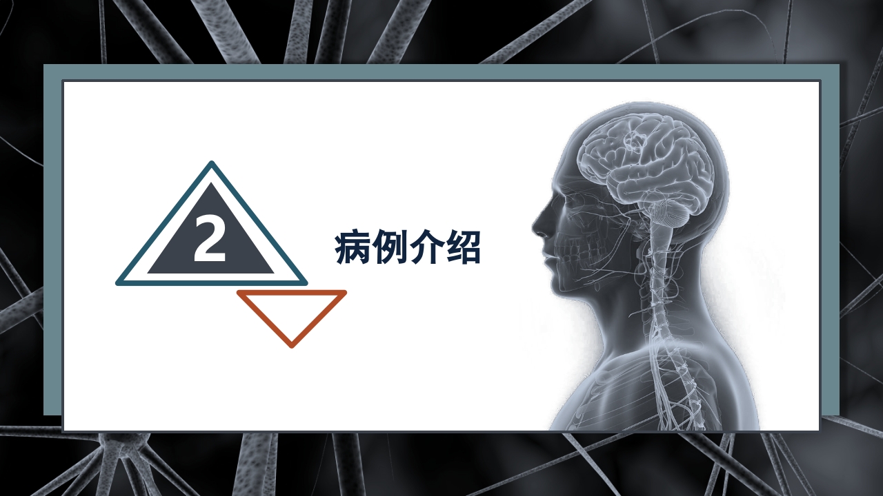 继发性癫痫患者护理查房PPT课件10