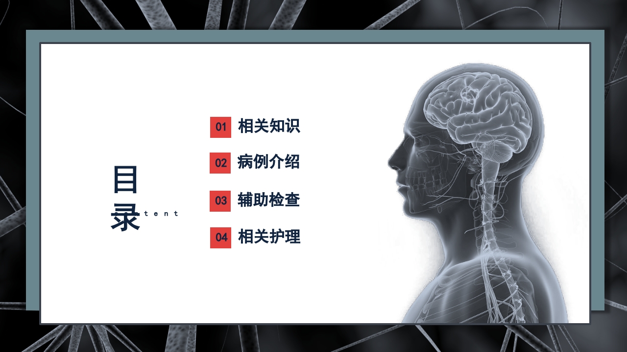 继发性癫痫患者护理查房PPT课件2