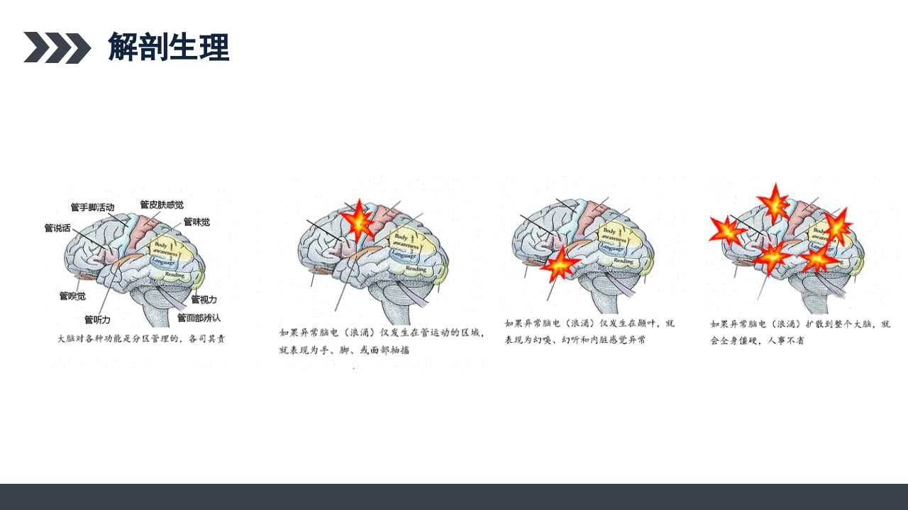 继发性癫痫患者护理查房PPT课件5