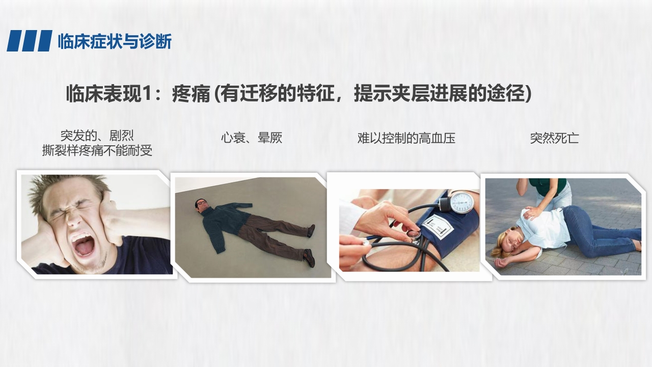 医学医药医疗主动脉夹层PPT课件10