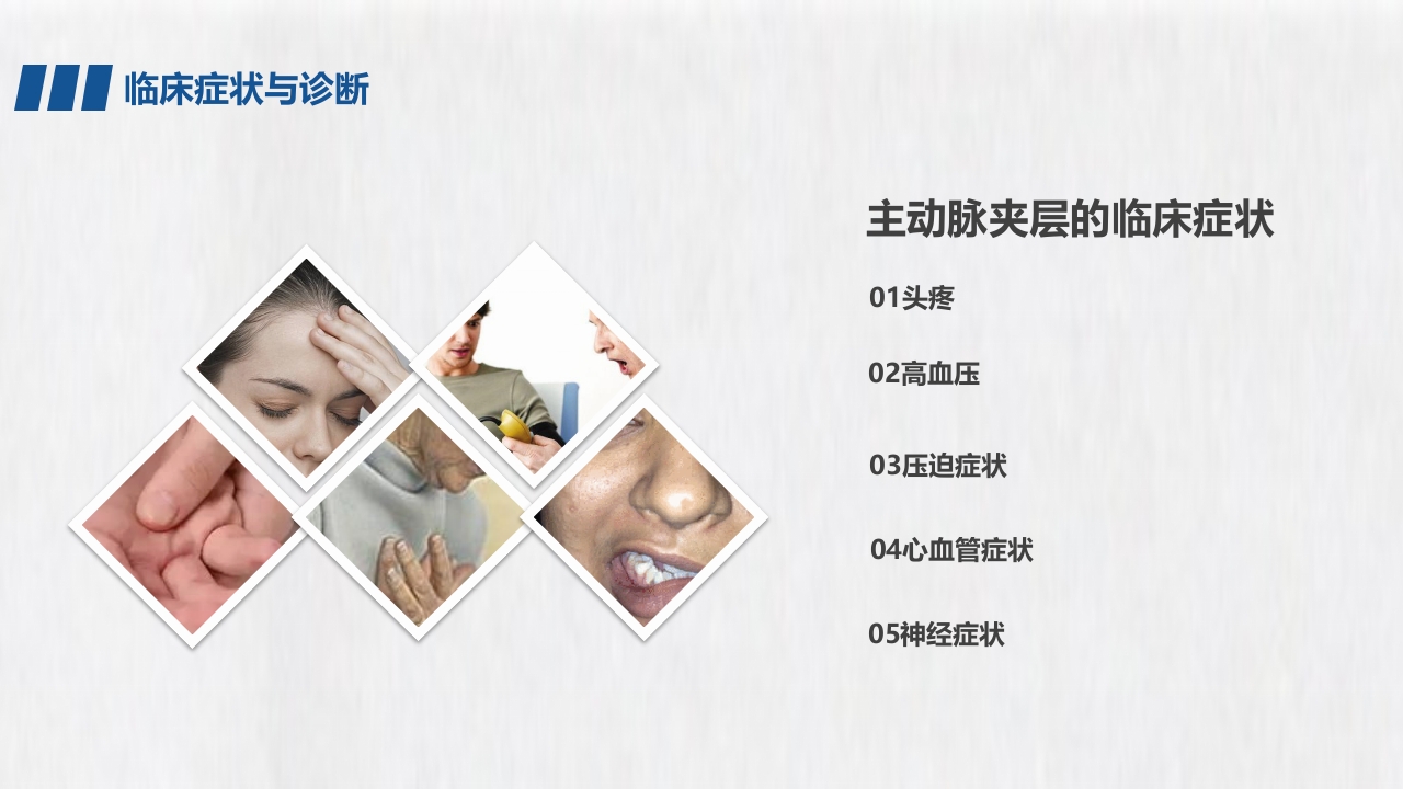 医学医药医疗主动脉夹层PPT课件9