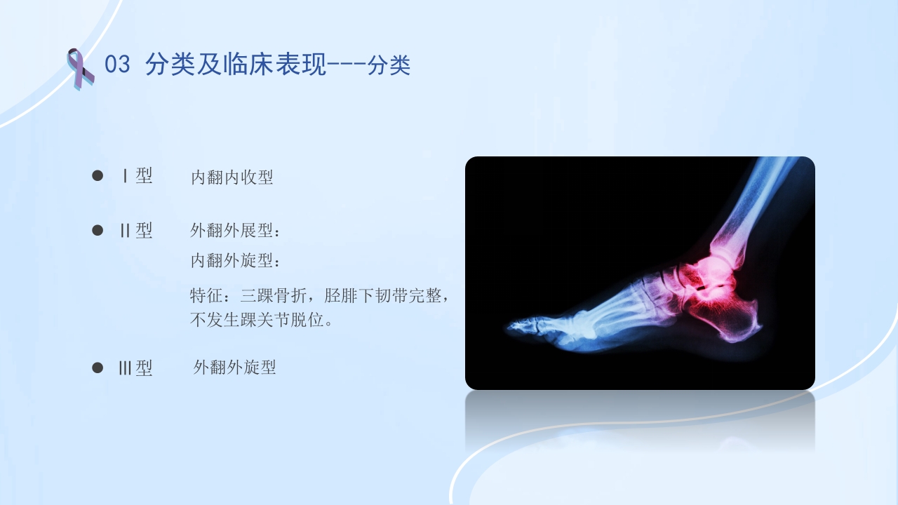 踝关节骨折护理查房护理PPT课件12