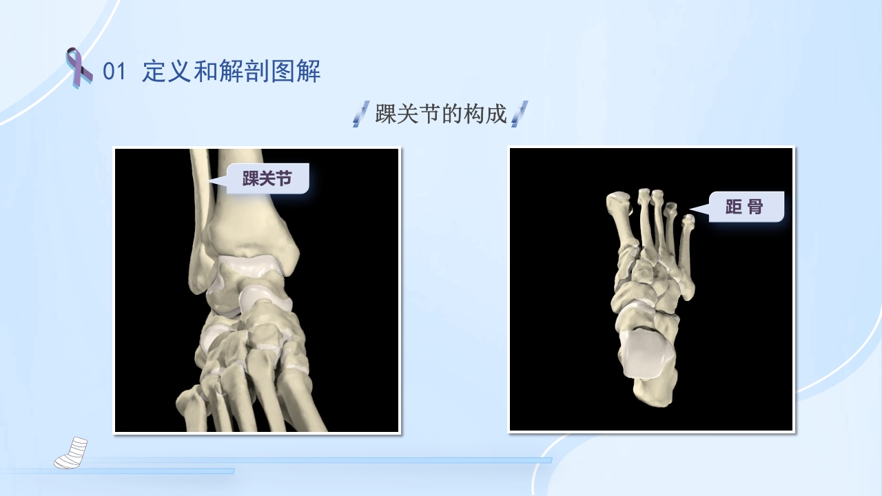 踝关节骨折护理查房护理PPT课件6
