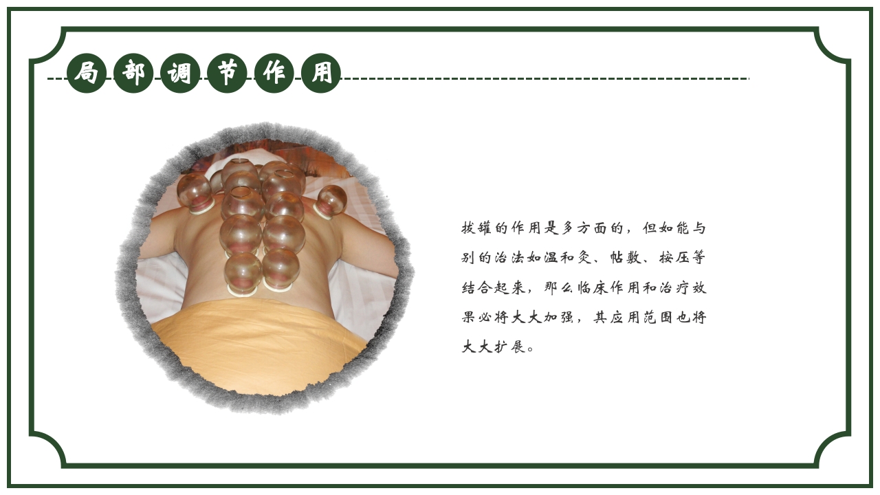 中医护理养生八大操作之一拔罐疗法课件ppt课件11