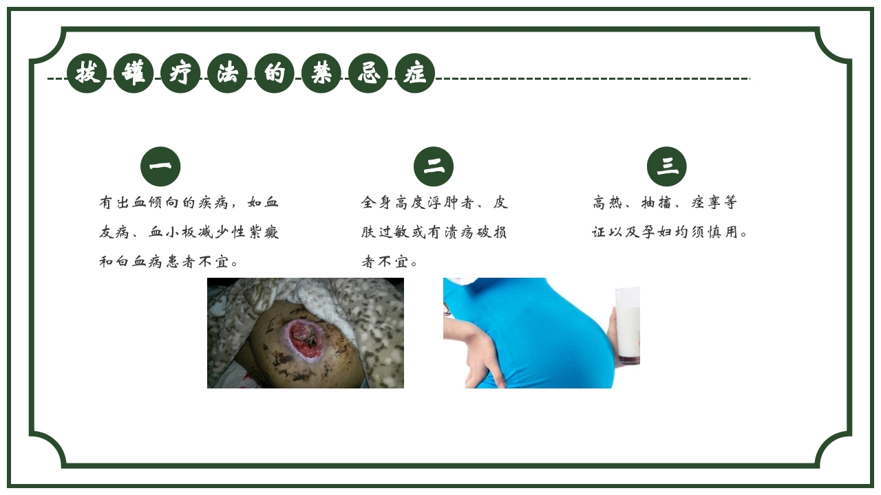 中医护理养生八大操作之一拔罐疗法课件ppt课件18