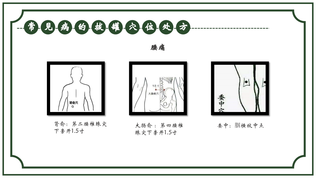 中医护理养生八大操作之一拔罐疗法课件ppt课件23