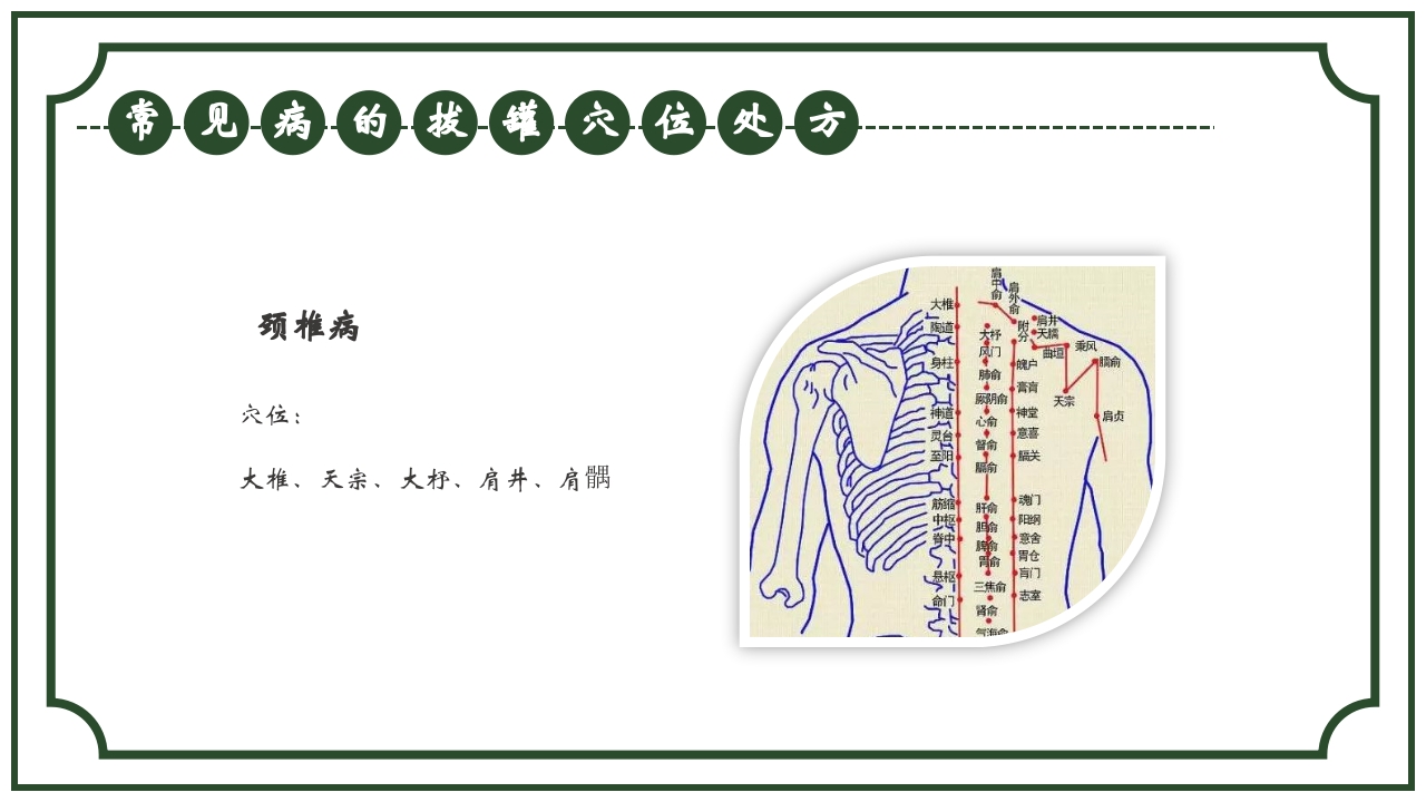 中医护理养生八大操作之一拔罐疗法课件ppt课件24