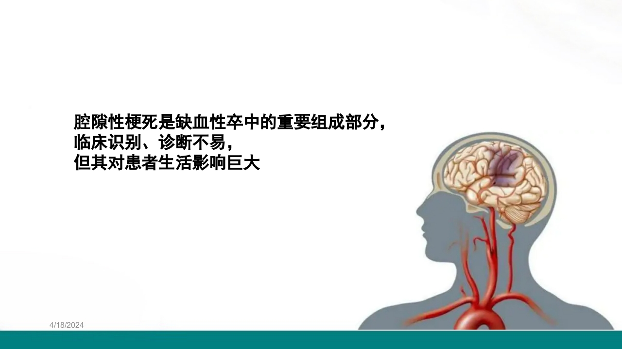 腔隙性脑梗死PPT课件下载4