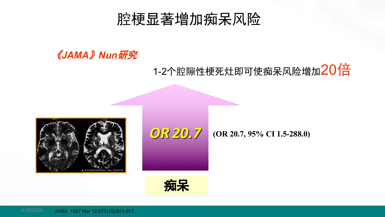 腔隙性脑梗死PPT课件下载5