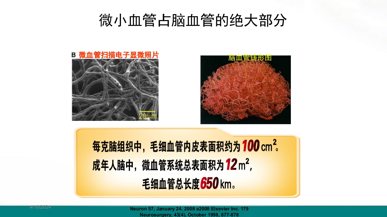 腔隙性脑梗死PPT课件下载8