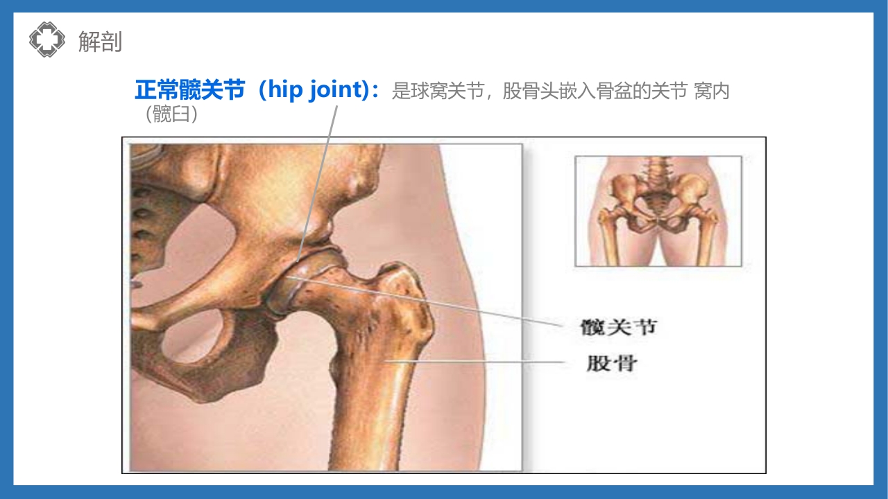 股骨颈骨折护理查房PPT课件10