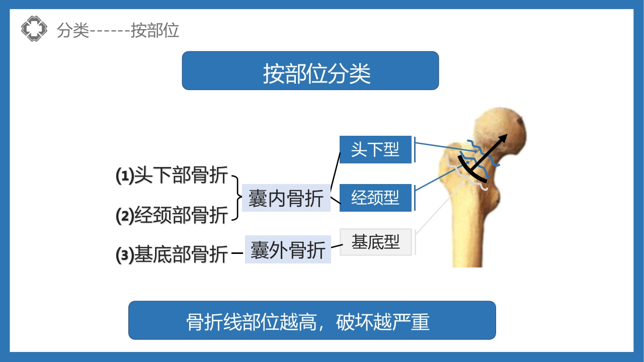 股骨颈骨折护理查房PPT课件13