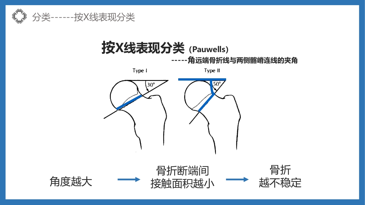 股骨颈骨折护理查房PPT课件14