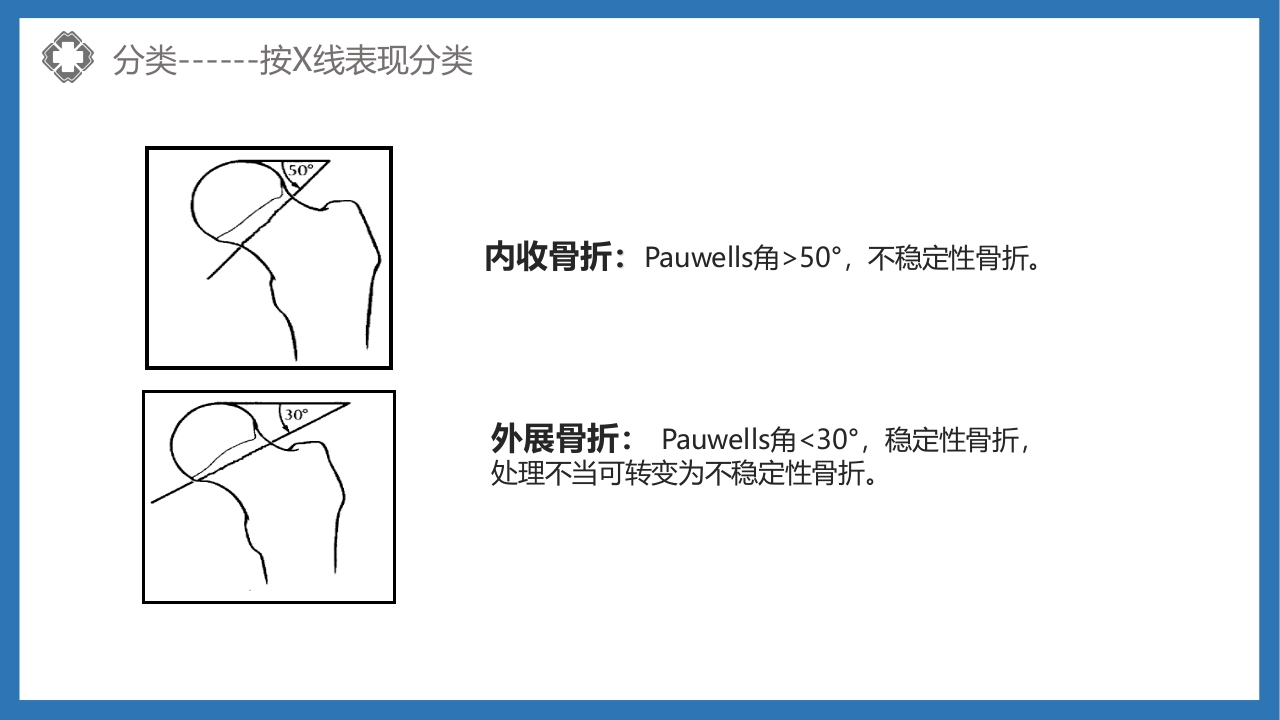 股骨颈骨折护理查房PPT课件15