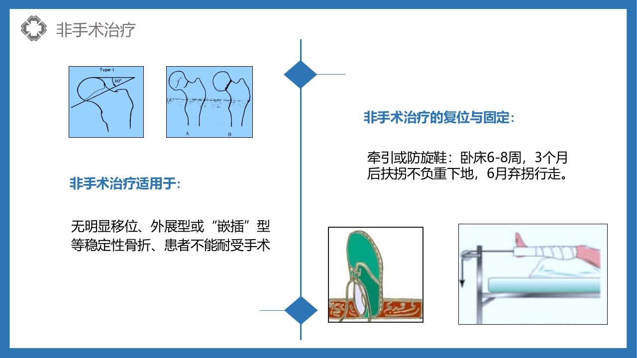股骨颈骨折护理查房PPT课件21