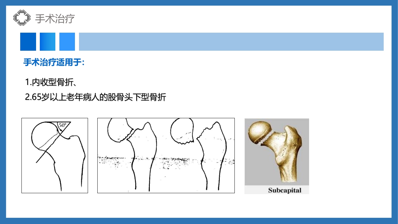 股骨颈骨折护理查房PPT课件22