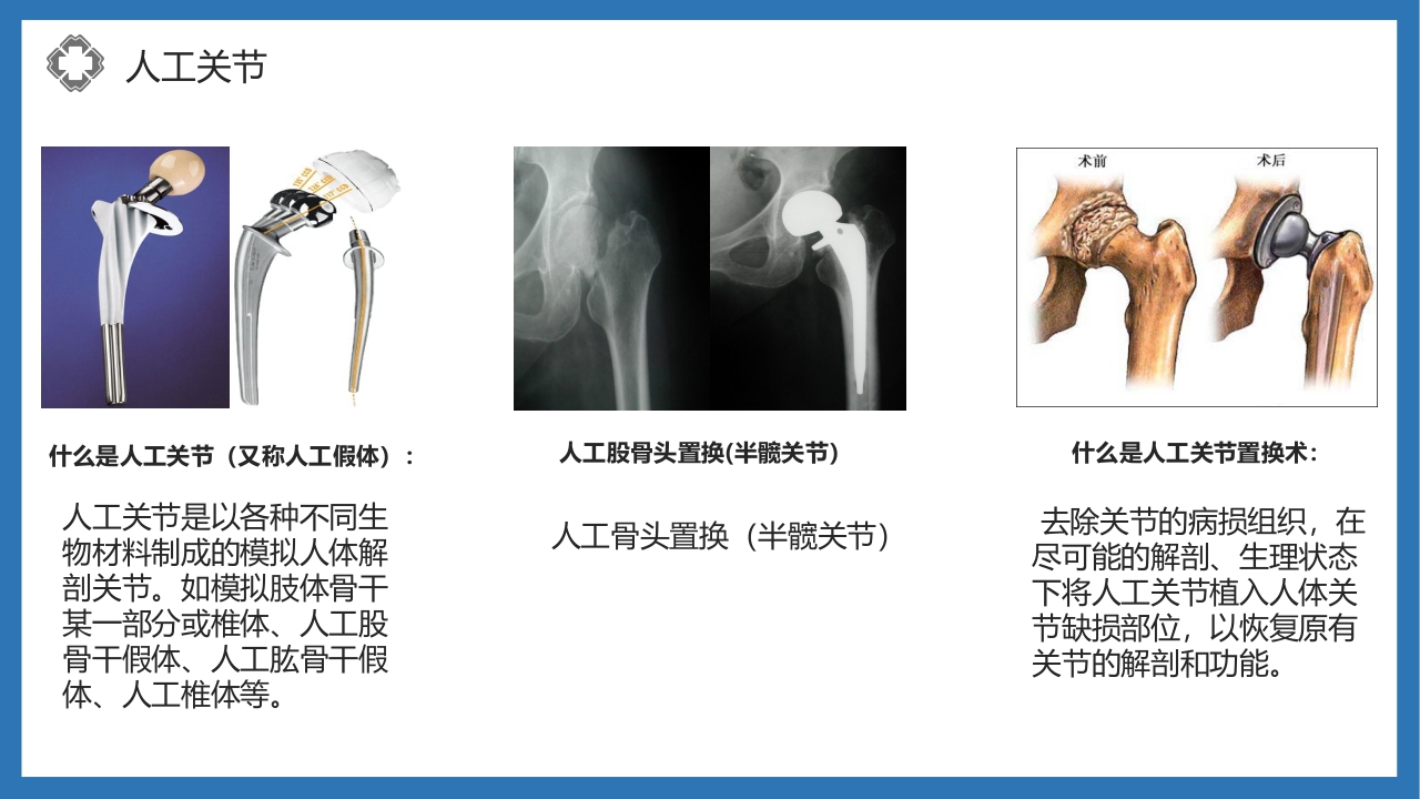 股骨颈骨折护理查房PPT课件25