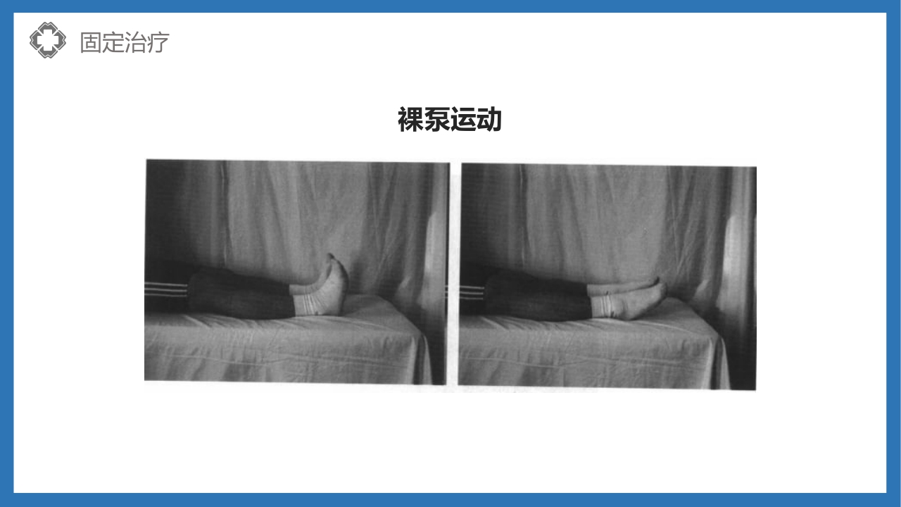 股骨颈骨折护理查房PPT课件28