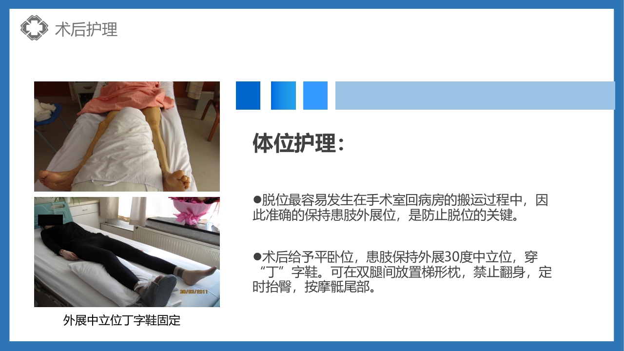 股骨颈骨折护理查房PPT课件29