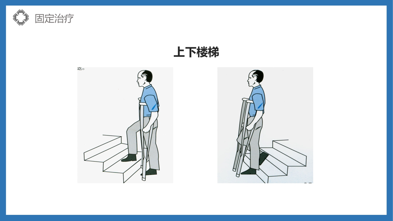 股骨颈骨折护理查房PPT课件48