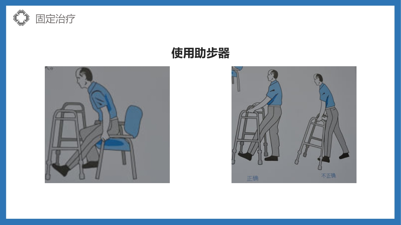股骨颈骨折护理查房PPT课件51