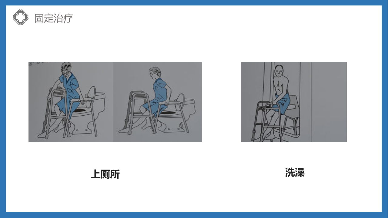股骨颈骨折护理查房PPT课件53