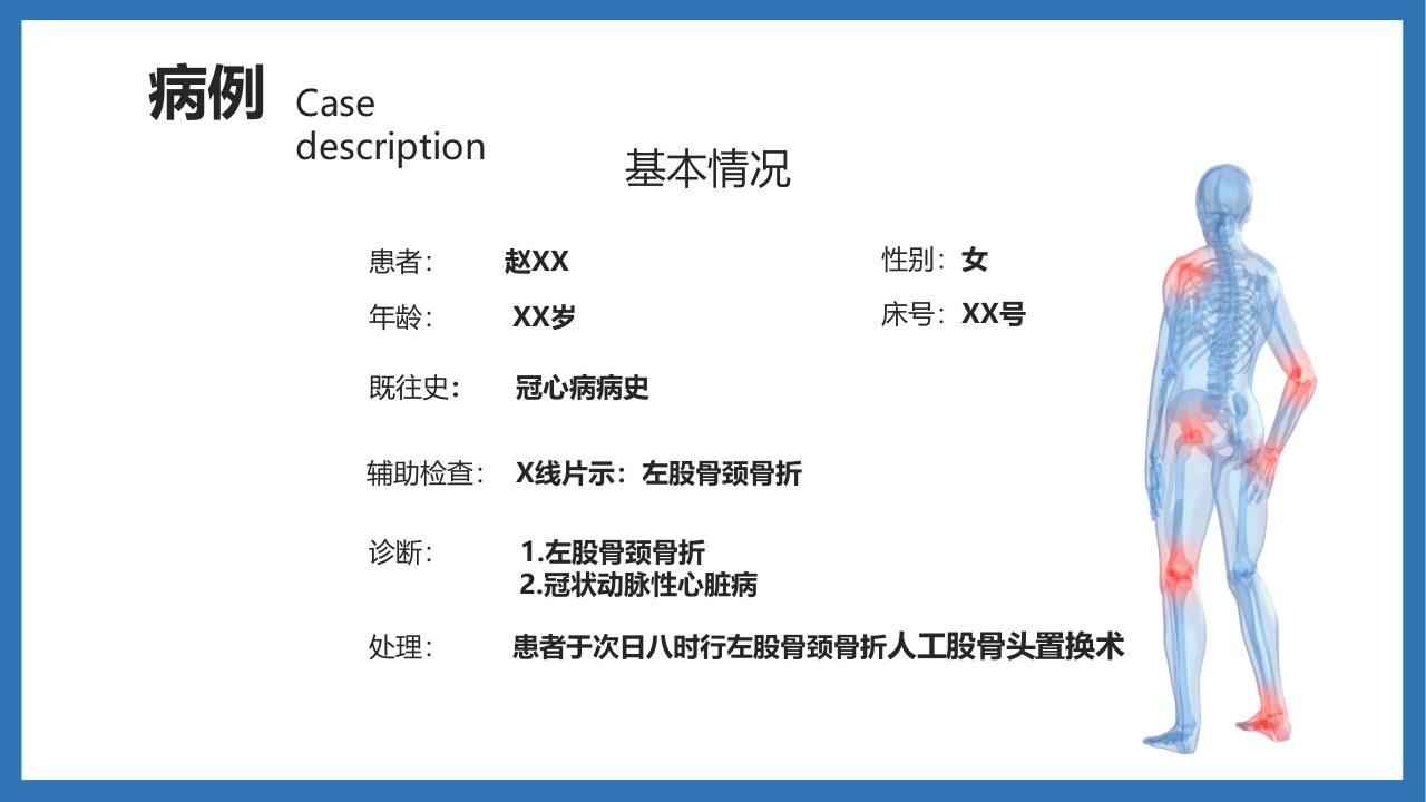 股骨颈骨折护理查房PPT课件5
