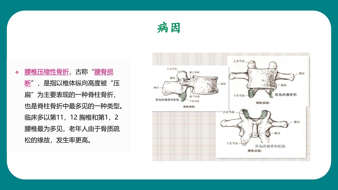 腰椎骨科护理查房PPT课件4