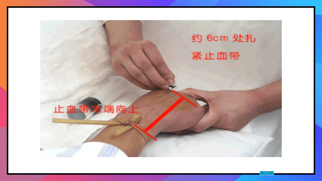 静脉输液和输血课件PPT下载105