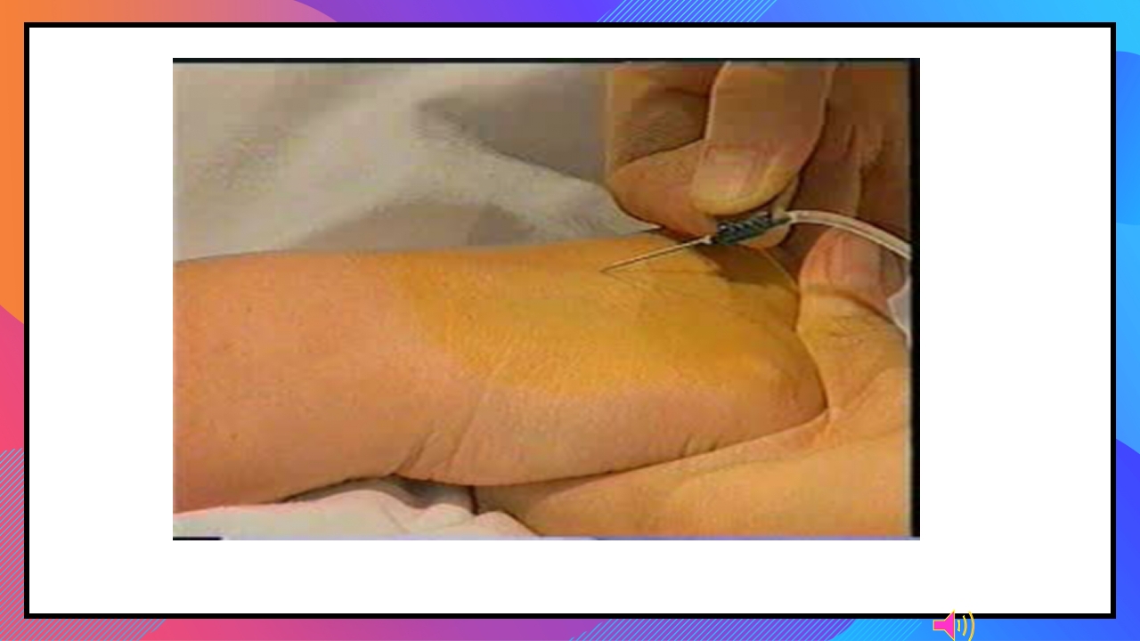 静脉输液和输血课件PPT下载106