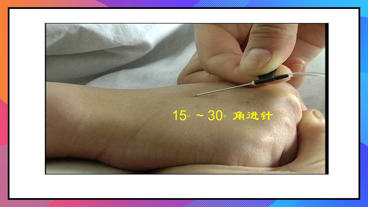 静脉输液和输血课件PPT下载107