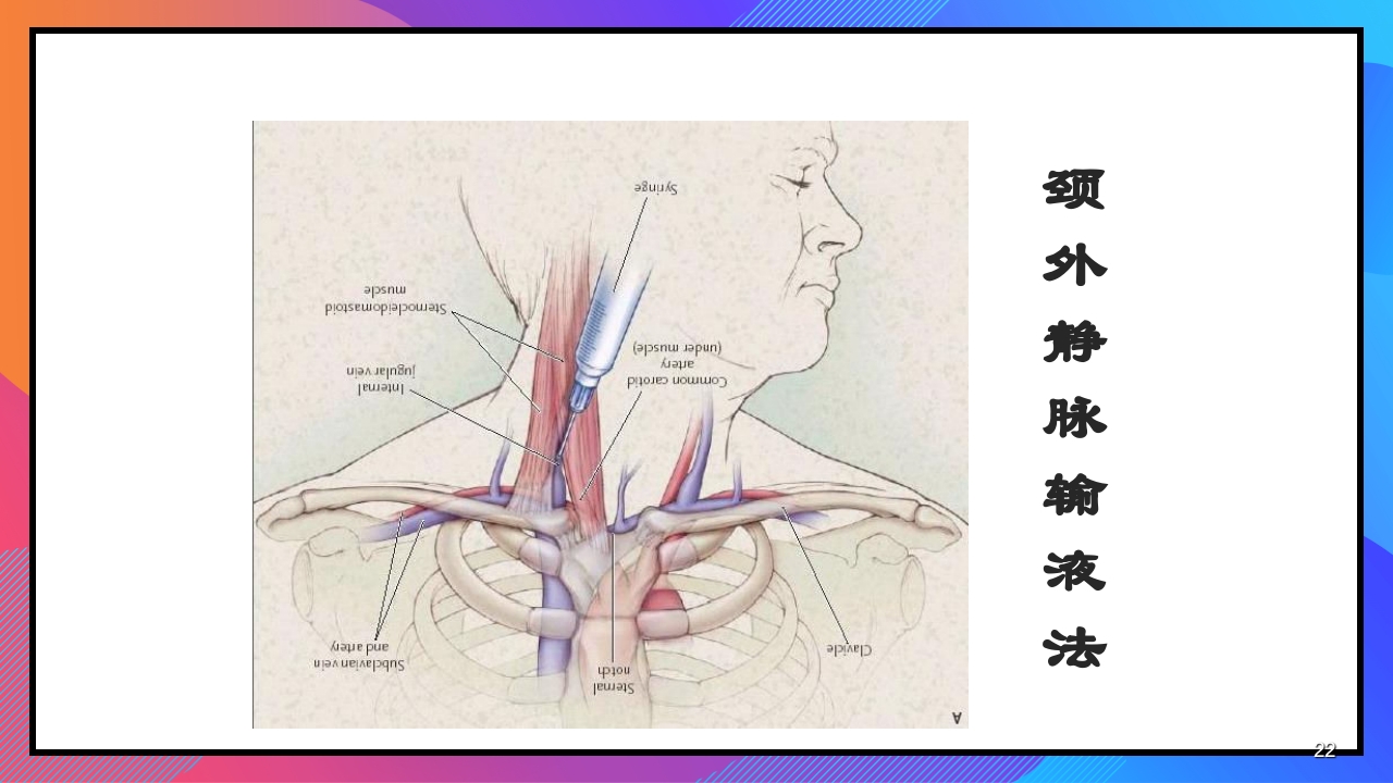 静脉输液和输血课件PPT下载22