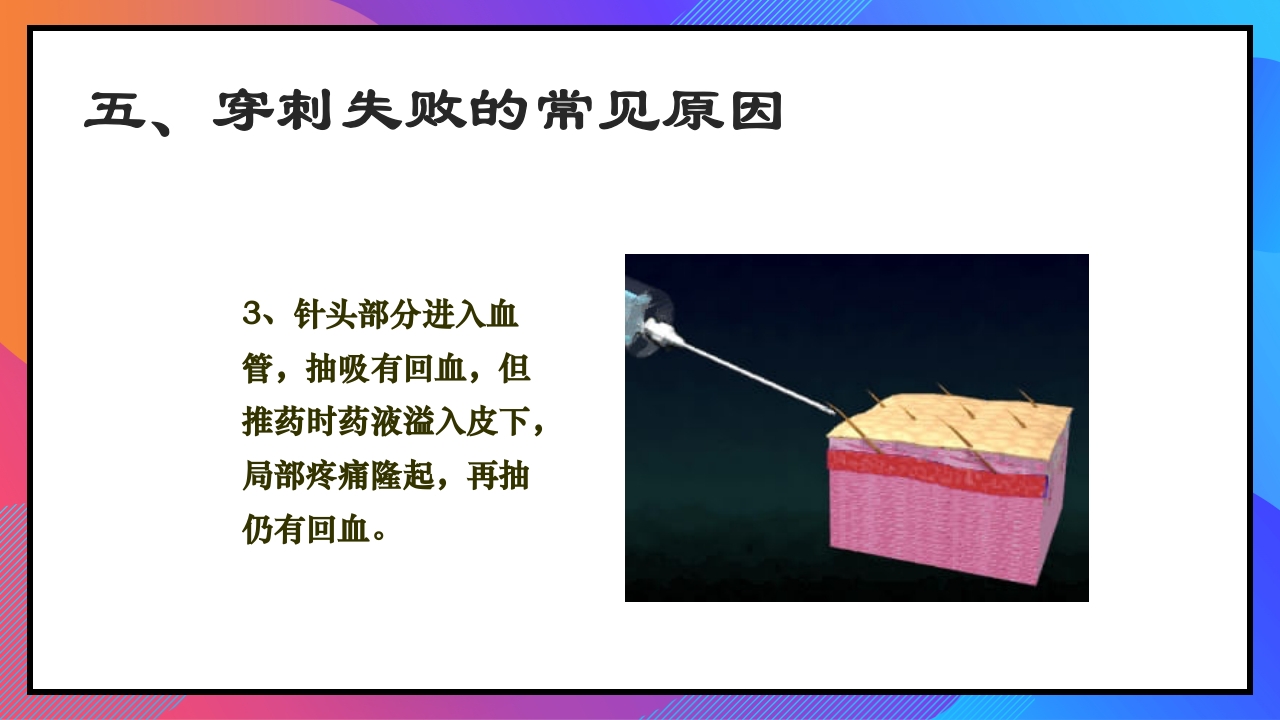 静脉输液和输血课件PPT下载29