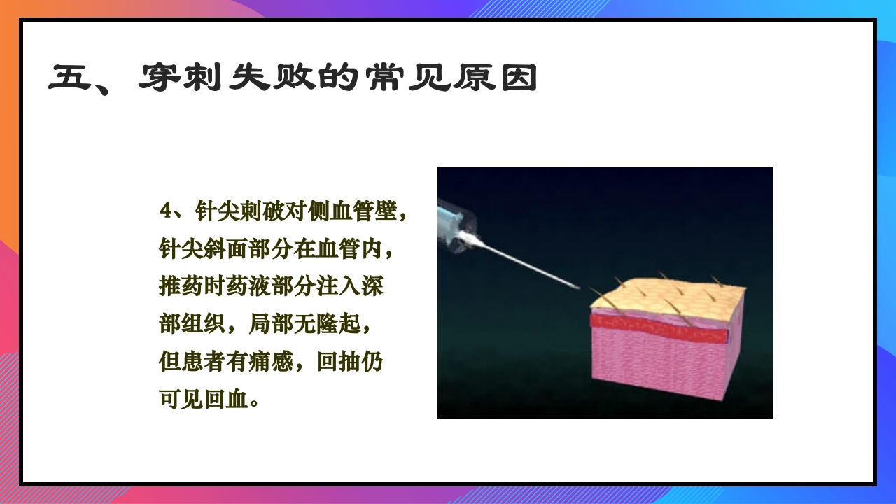 静脉输液和输血课件PPT下载30