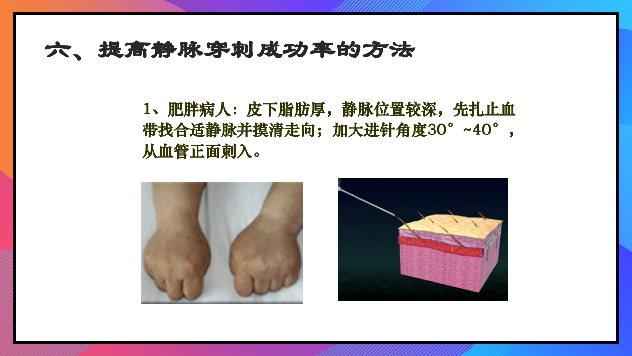 静脉输液和输血课件PPT下载32