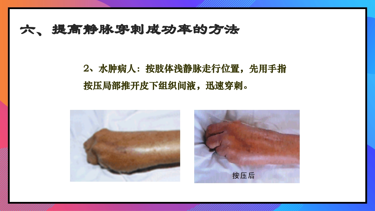 静脉输液和输血课件PPT下载33