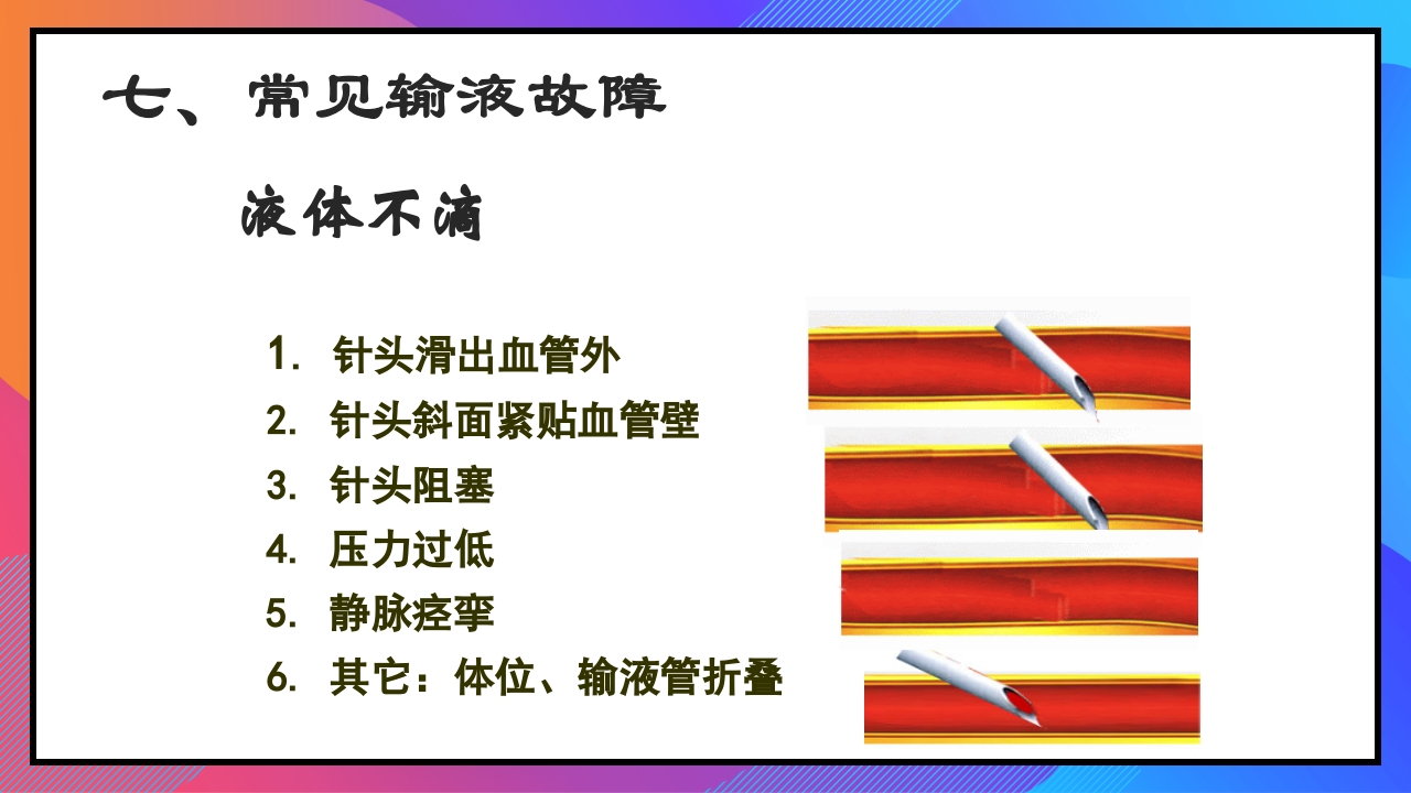 静脉输液和输血课件PPT下载37