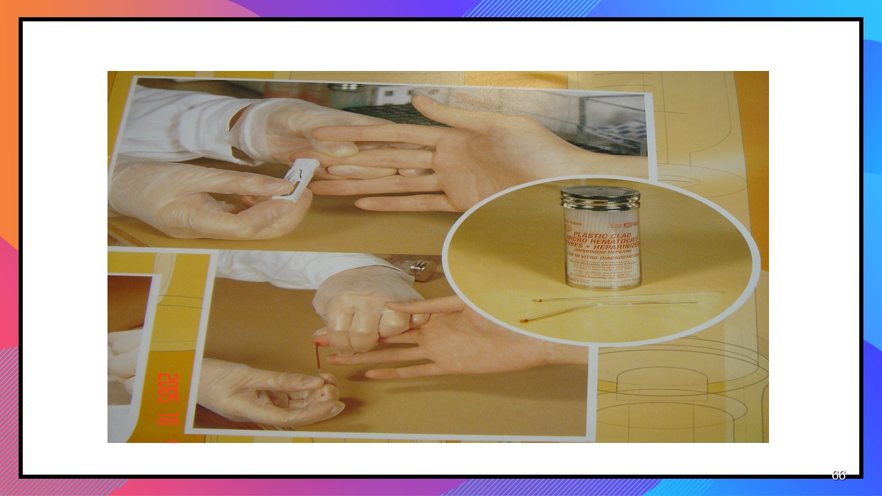 静脉输液和输血课件PPT下载66