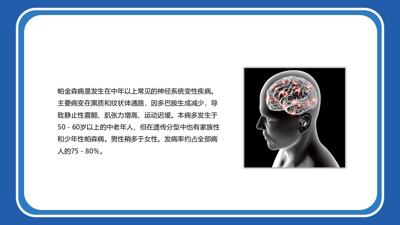 帕金森病护理查房PPT课件4