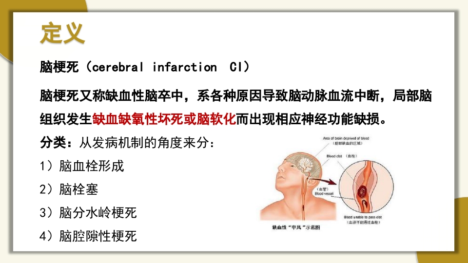 脑梗死的护理PPT课件2