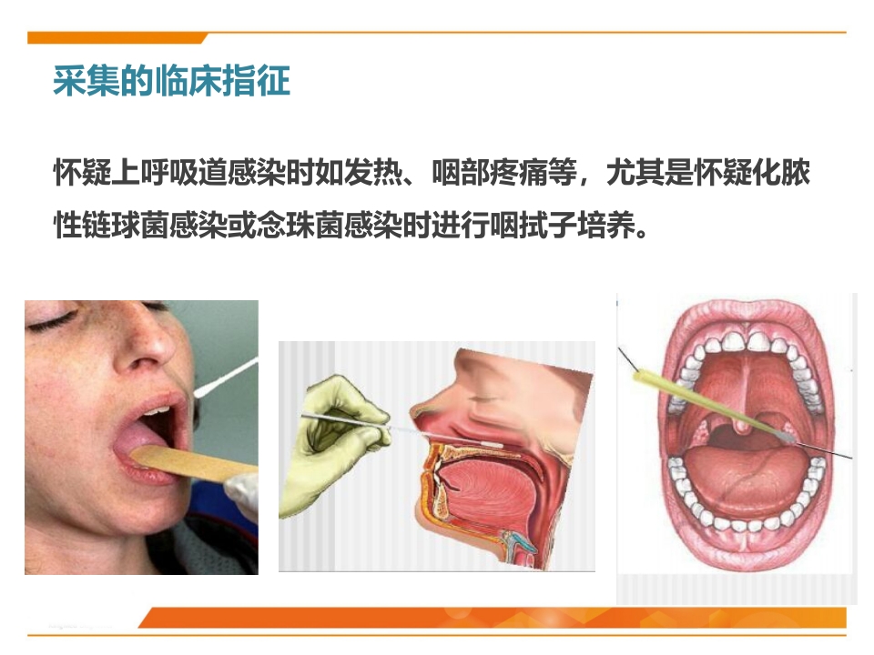 临床微生物标本采集与运送PPT课件15