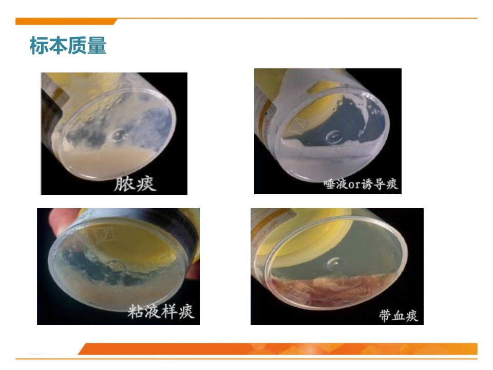 临床微生物标本采集与运送PPT课件22