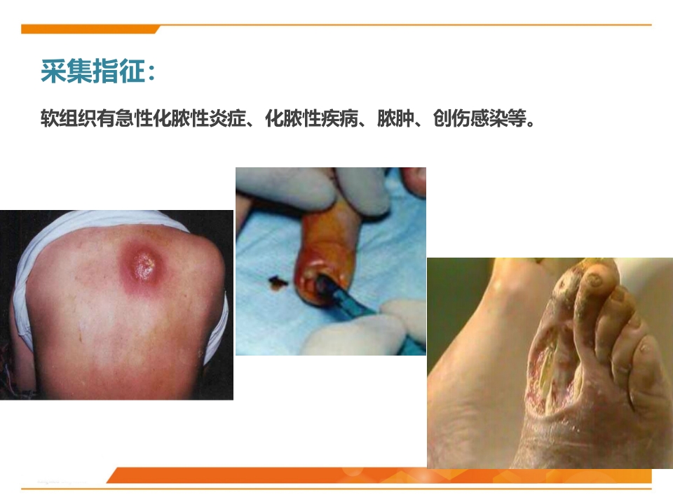 临床微生物标本采集与运送PPT课件45