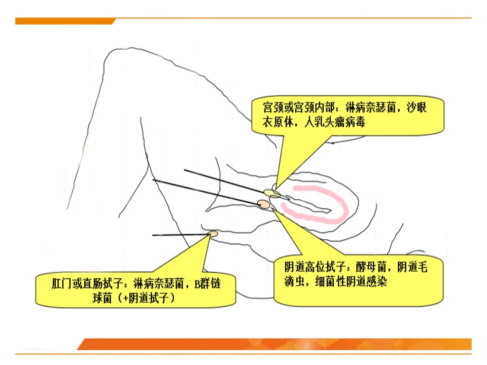 临床微生物标本采集与运送PPT课件49