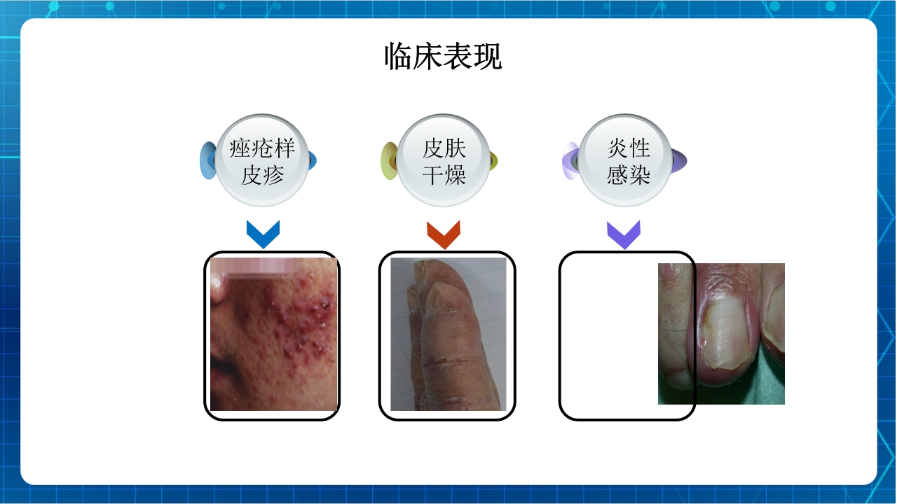抗肿瘤靶向药物治疗及护理PPT课件50