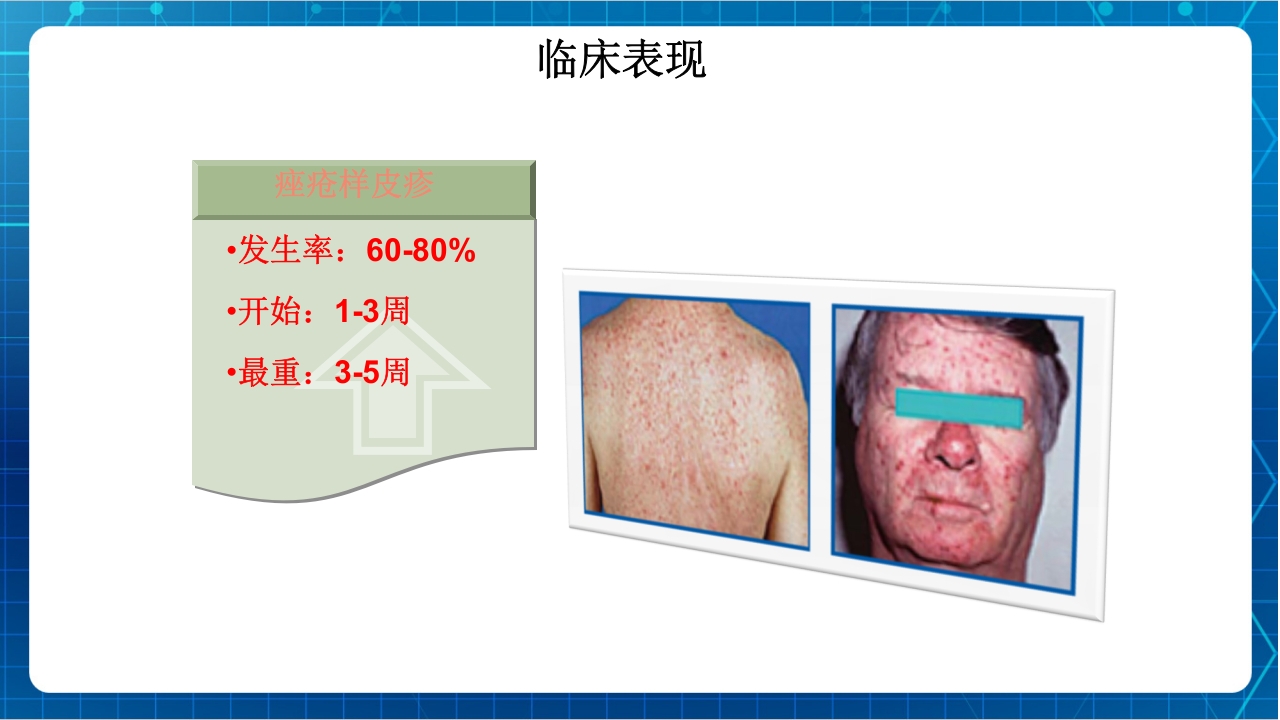 抗肿瘤靶向药物治疗及护理PPT课件51