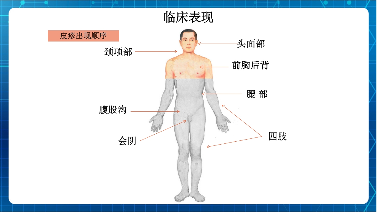 抗肿瘤靶向药物治疗及护理PPT课件52
