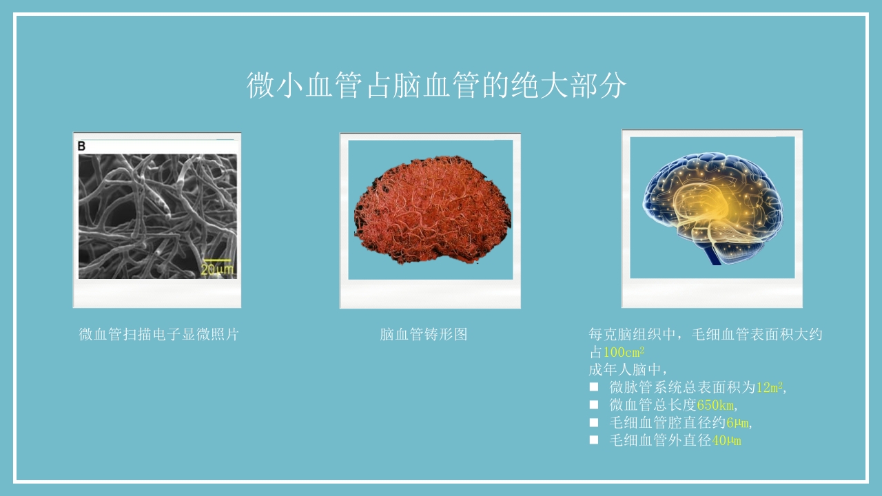 腔隙性脑梗死PPT医药医疗9